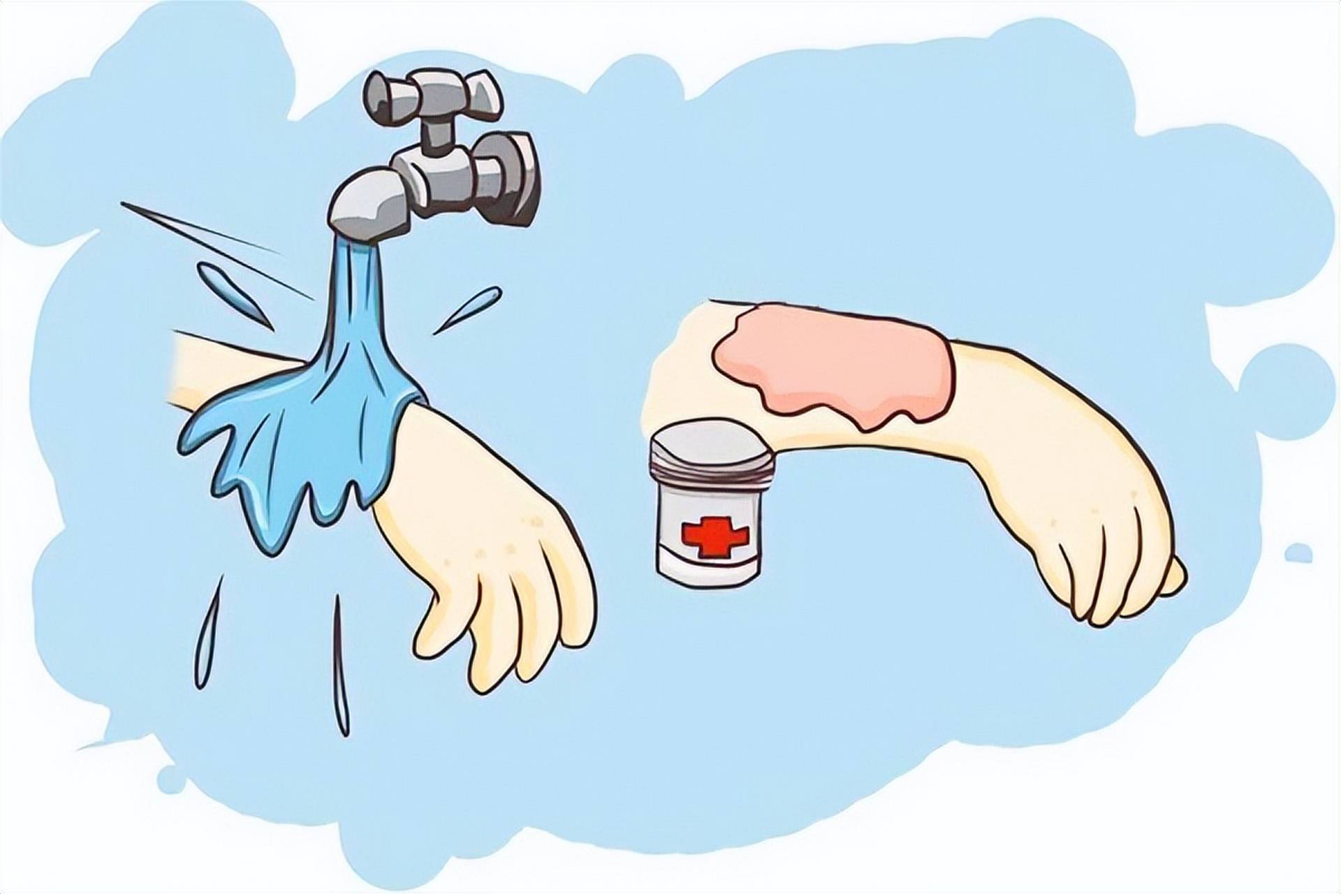 被狗狗咬伤不一定会感染狂犬病,如果狗狗接种过狂犬疫苗,咬伤后不需要