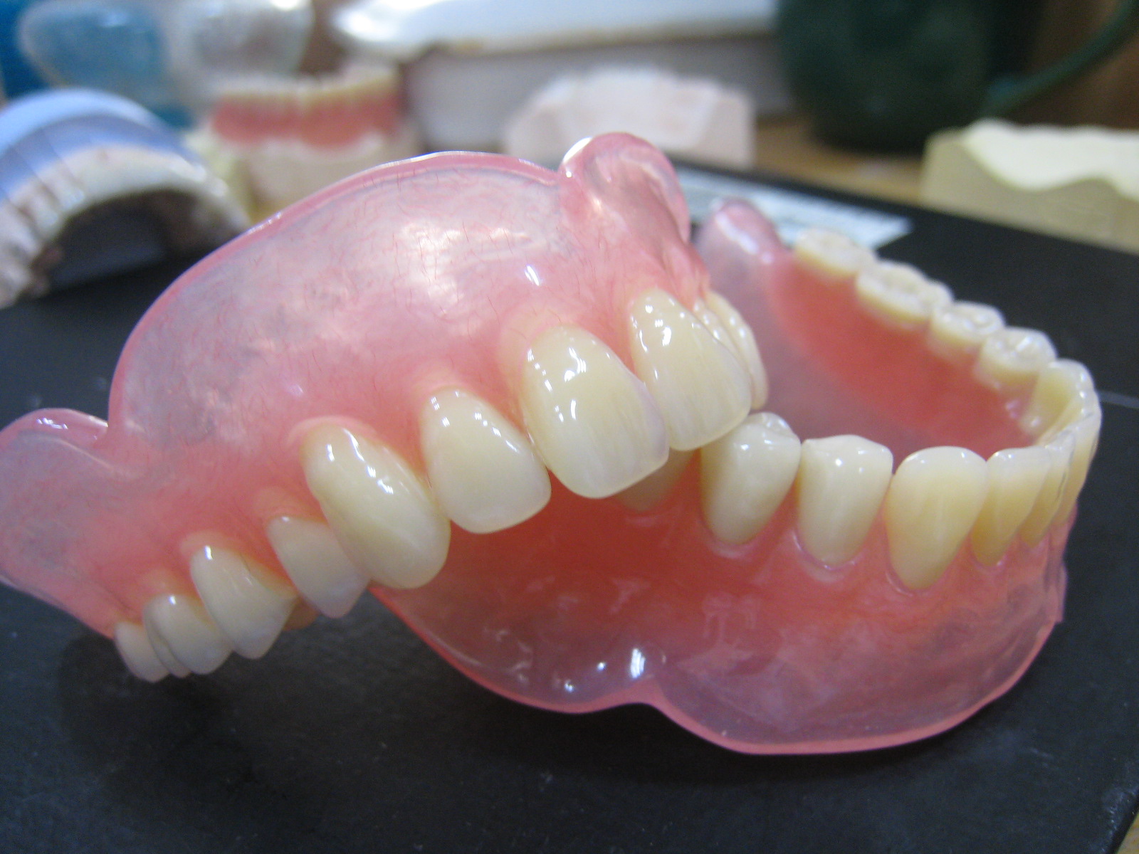 种植牙和镶牙哪个好?