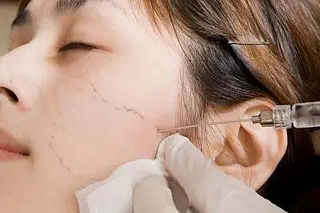 19年河南母亲整容时死亡,生前曾被全身麻醉,家属讨要协议时被拒