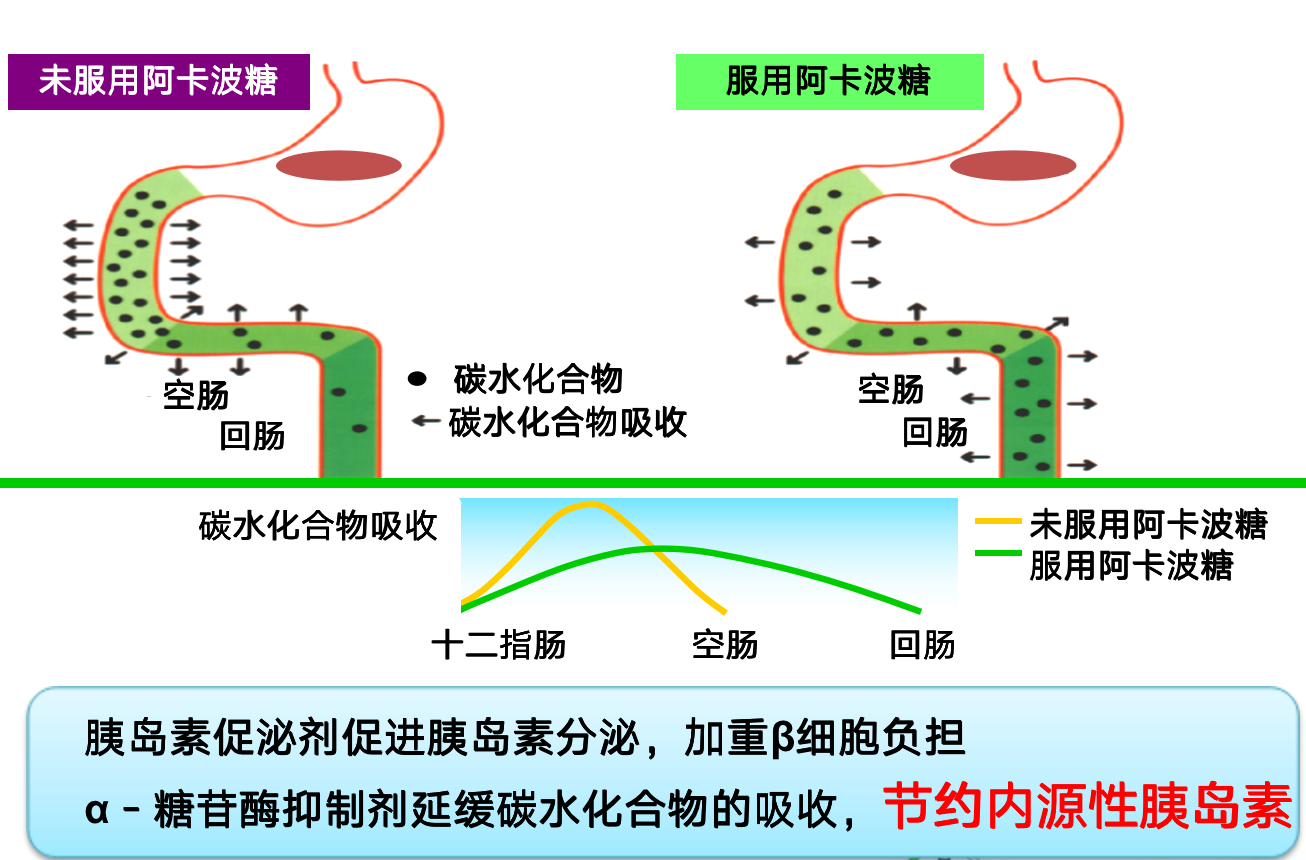 阿卡波糖是如何正确控制血糖的?