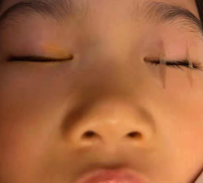 睡觉眼睛闭不上是为什么?