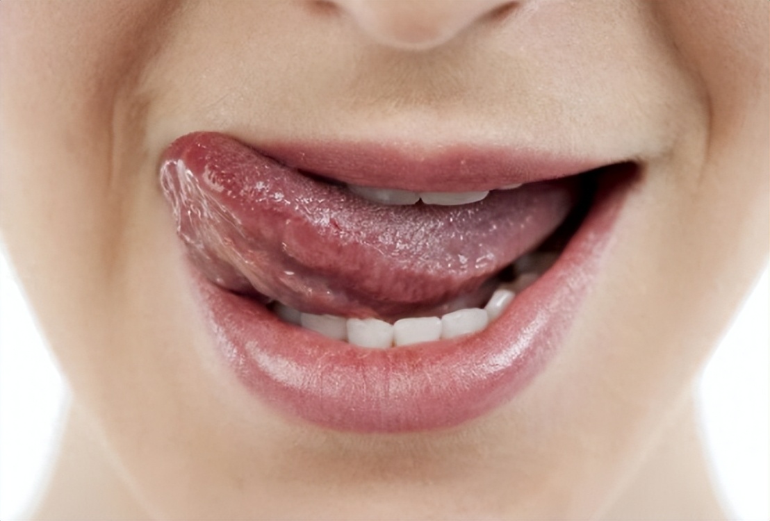 舌头下两条"青筋"又粗又黑,到底是怎么回事呢?