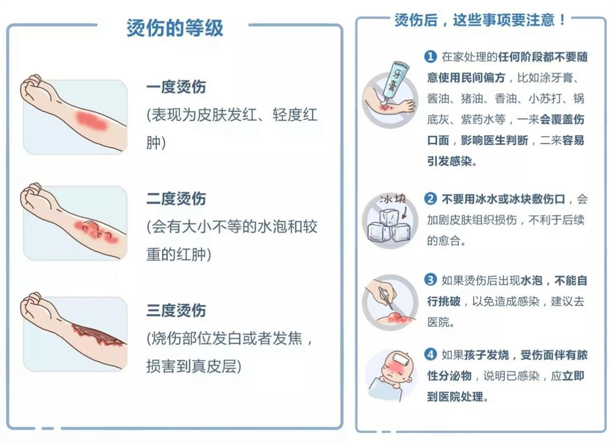 小孩烫伤怎么处理图片