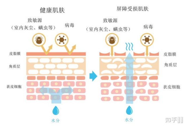 為什麼皮膚越補水越幹