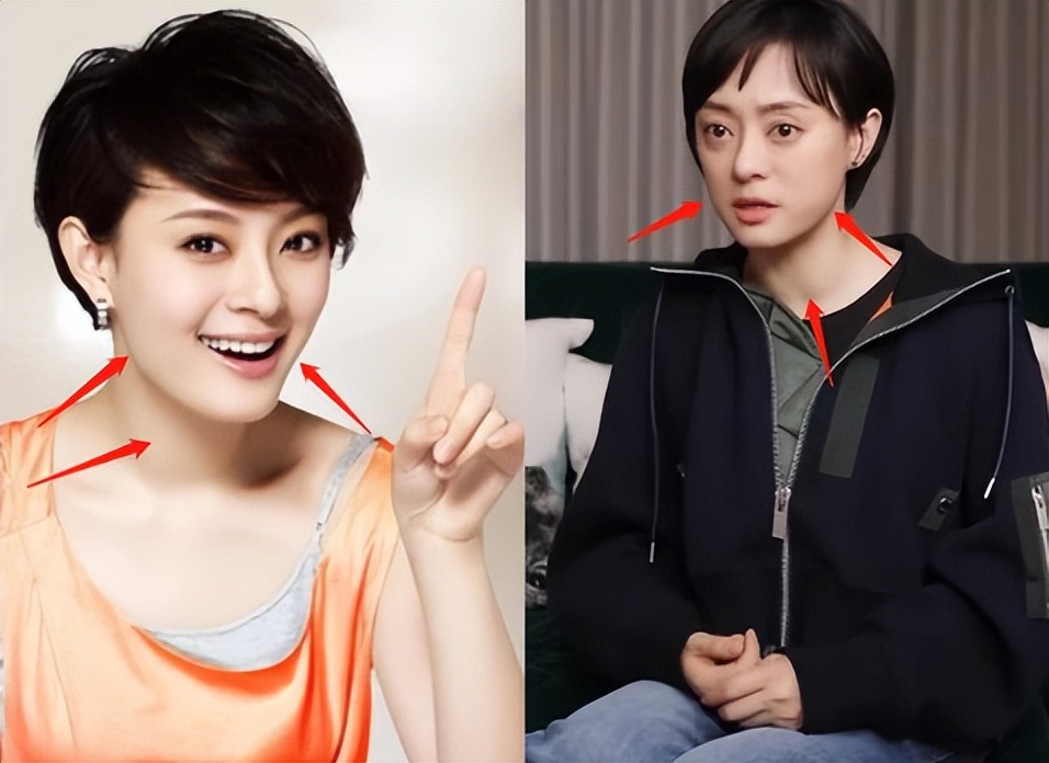 秃头眼凸,五官发腮,"过度养生"的孙俪,还能维持住体面吗?