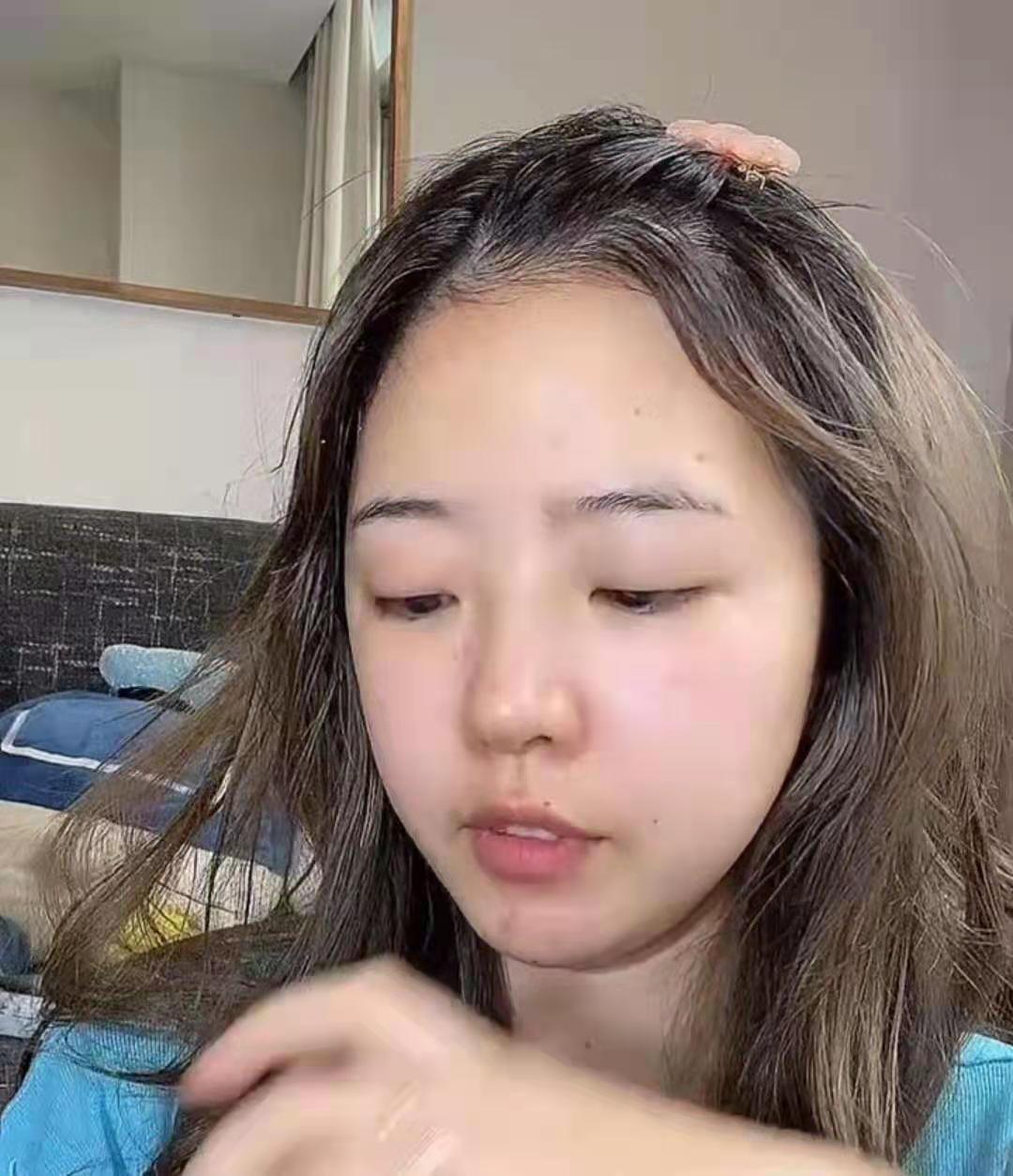 郝一点整容成功了?直播露脸细节曝光,和之前大变样