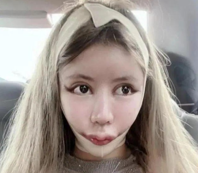 回顾上海00后整容狂人全身上下都动过2年花400万现在后悔了