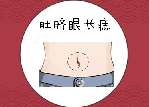 身上5颗"黄金"痣,个个值千金,有车又有房,百里挑一的好命!