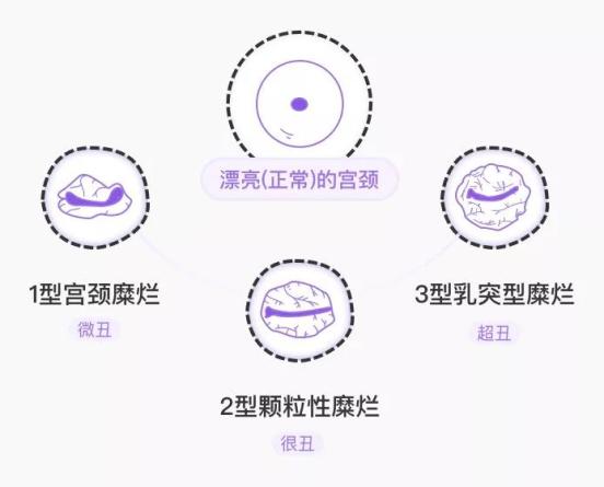 【健康科普】女性必知50条健康知识,最后一条特别重要!