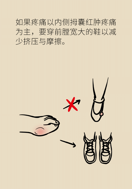 想要保护我们的脚,首先我们就要选最适合自己的鞋子,很多女生平常都