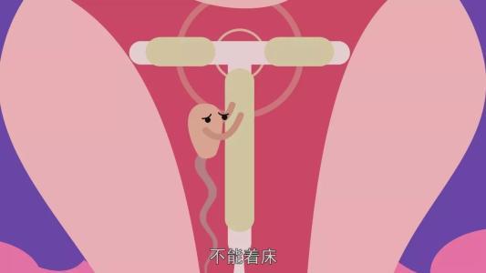 男女哪个结扎更有优势?医生告诉您答案