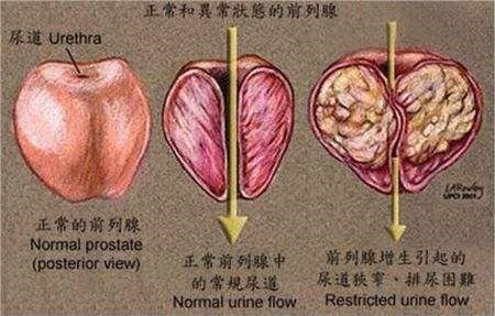 血管,甲狀腺有可能鈣化,還有哪些器官會發生鈣化?