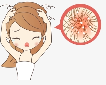 头发痒是什么原因引起的?这些方面不容忽视