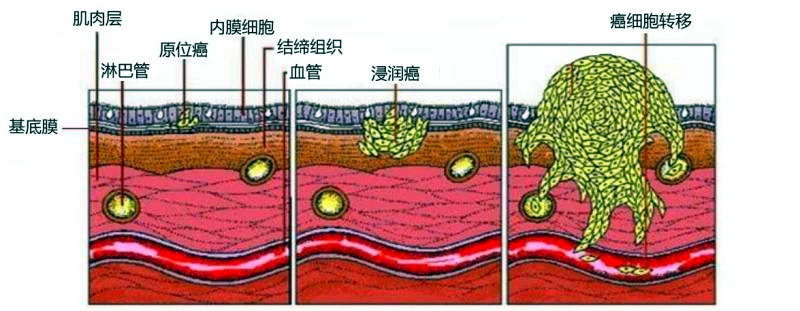 癌变的细胞是不是说明这些细胞在追求"永生"?