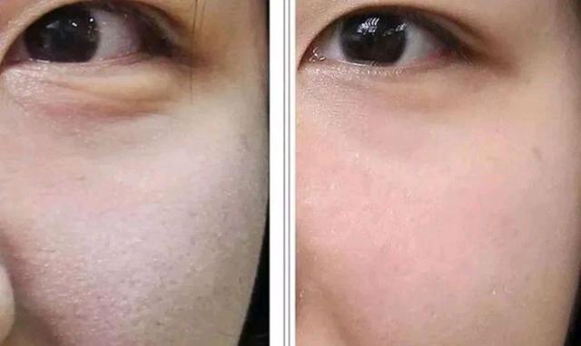 胶原蛋白怎么用于脸部?