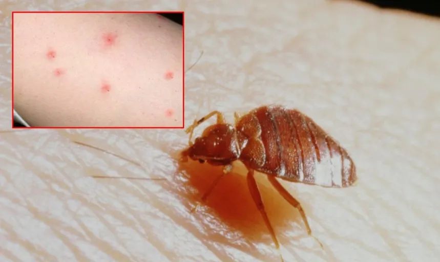 人哪有不疯的?韩国网友竟为报复邻居在二手市场求购吸血臭虫!