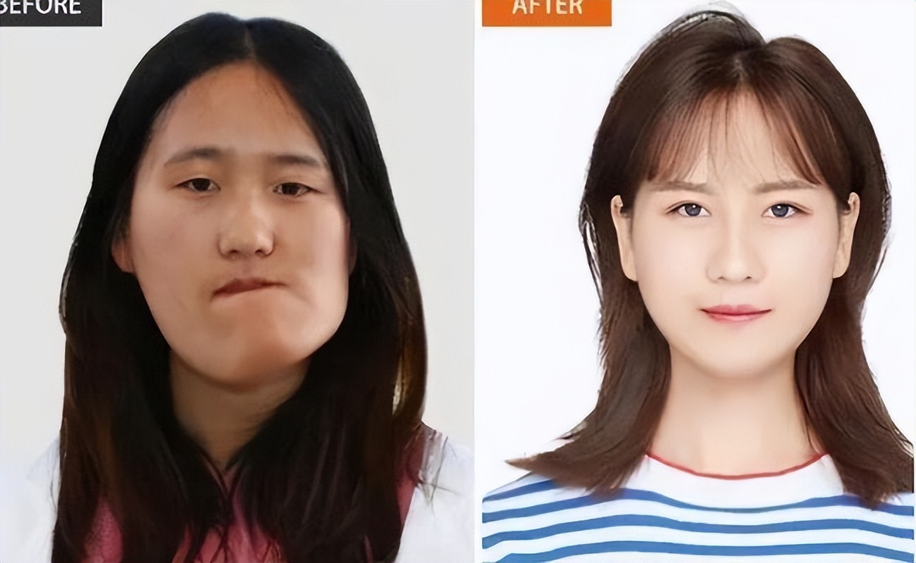 曾因长相吓人找不到工作!如今"换脸"后拒绝百万年薪