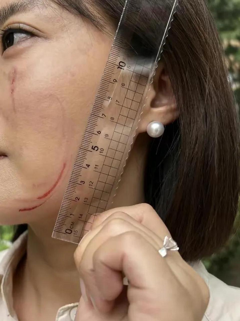 39岁女子曝在法院被女法官抓伤面部,法院回应:法官手上也有伤痕  近日