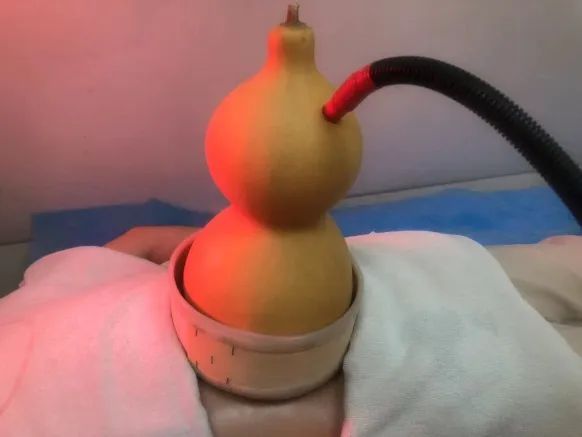 做过一次葫芦灸,才参透养生的境界