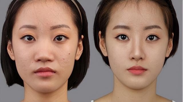 鼻整形前要明确