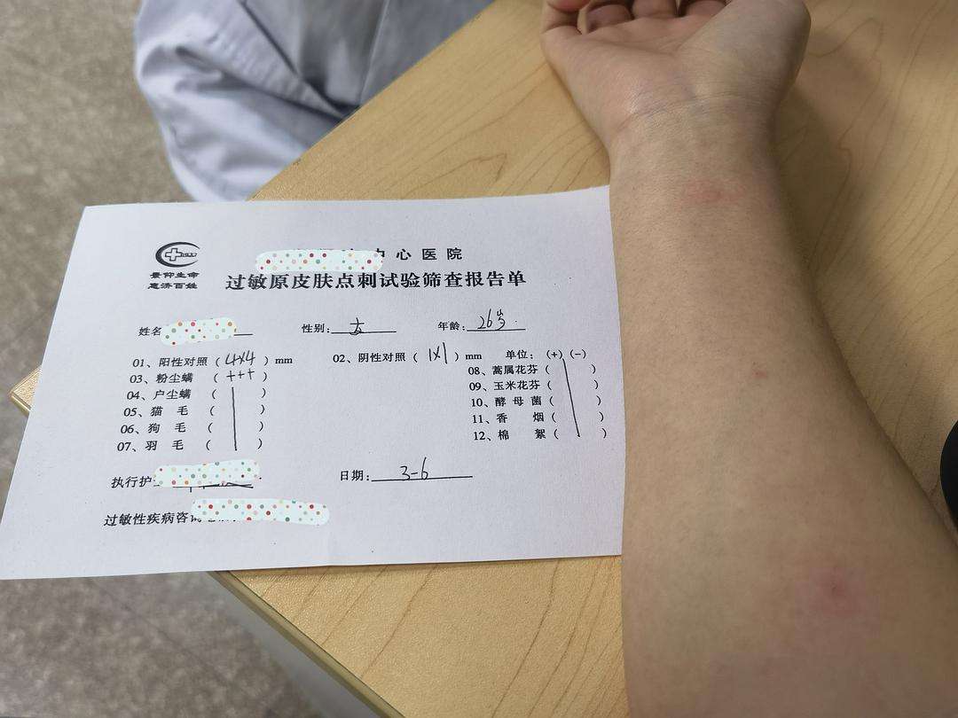 测过敏原有什么意义?建议皮肤敏感的人多了解