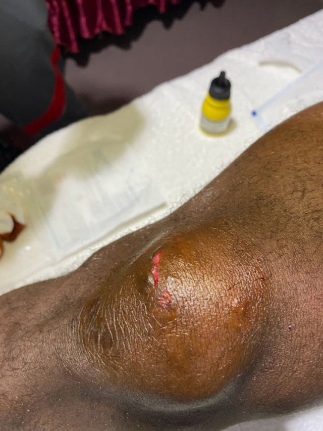 中超再现中国功夫!赵宏略飞踹巴索戈染红 导致后者膝盖红肿