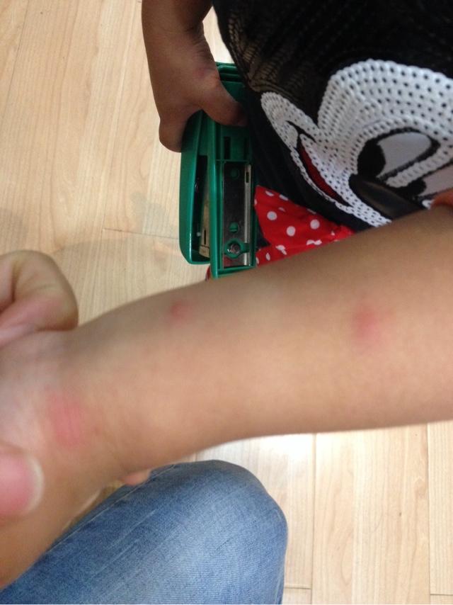 九成人不知道蚊子怕啥?教你一个小窍门,只需5分钟,蚊子自动消失