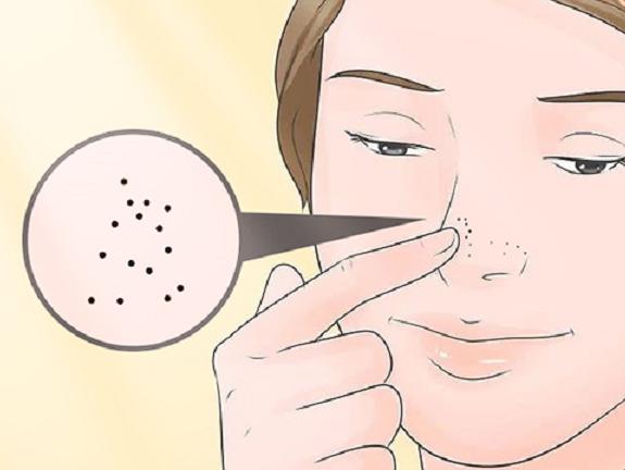 面部四种常见皮肤病治疗实用锦囊