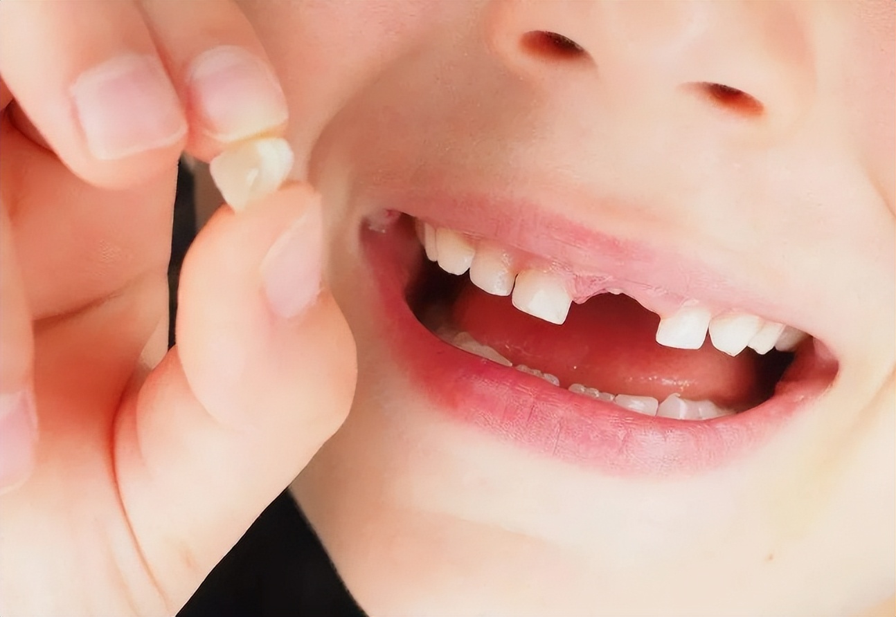 孩子到了换牙期,乳牙却迟迟不掉,当心变成双排牙,家长要注意