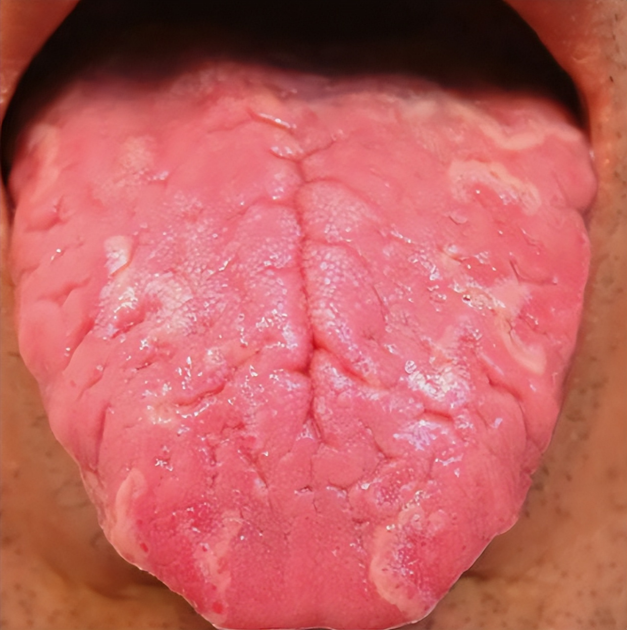 舌头纹路图片