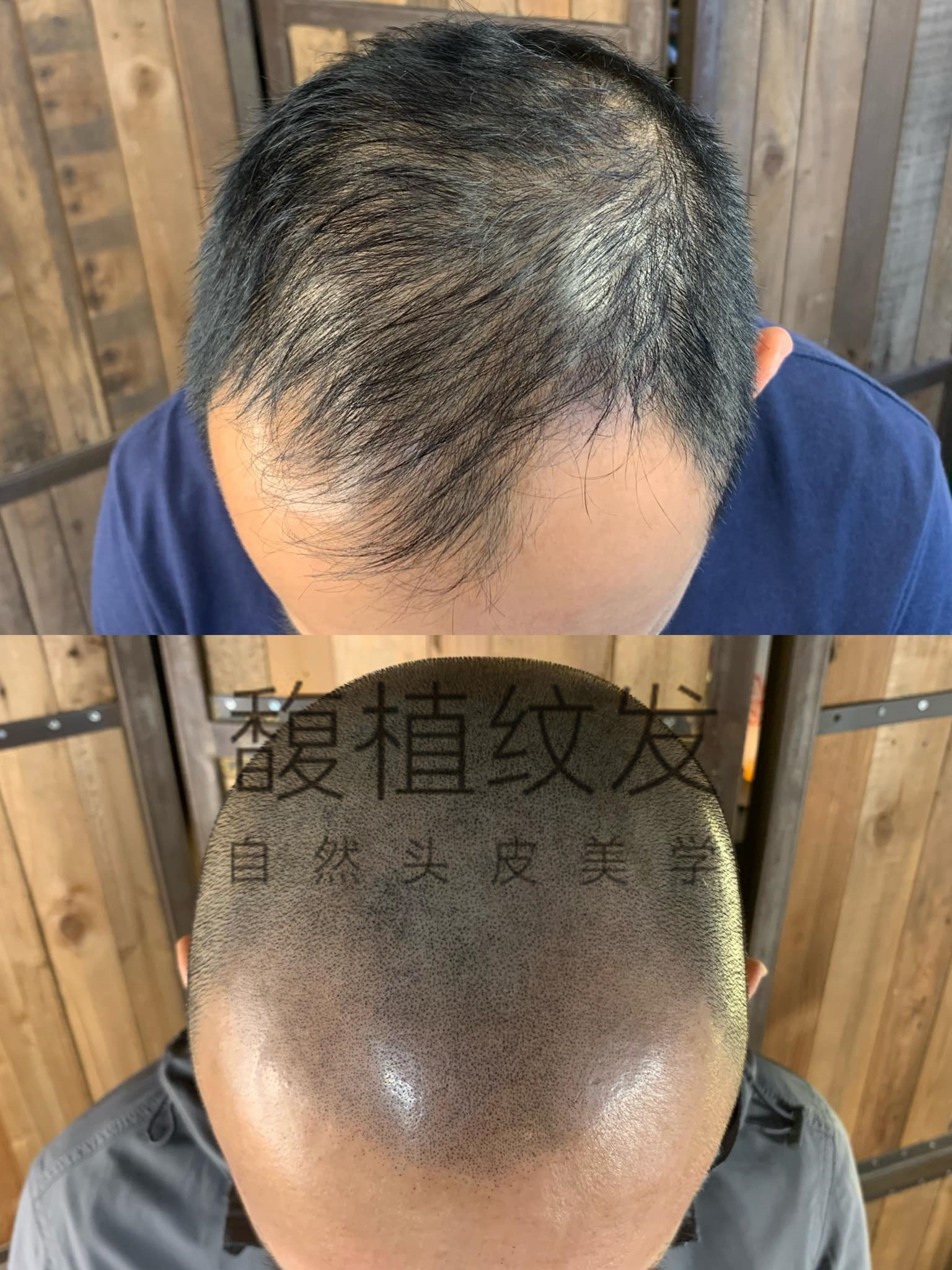 纹发会不会晕色?纹发会不会伤害毛囊?