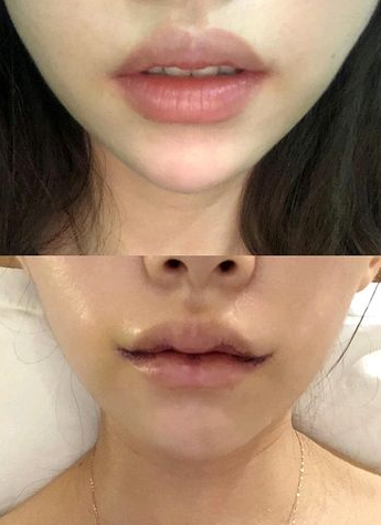 嘴角向下怎么改善 baijiahao.baidu.com
