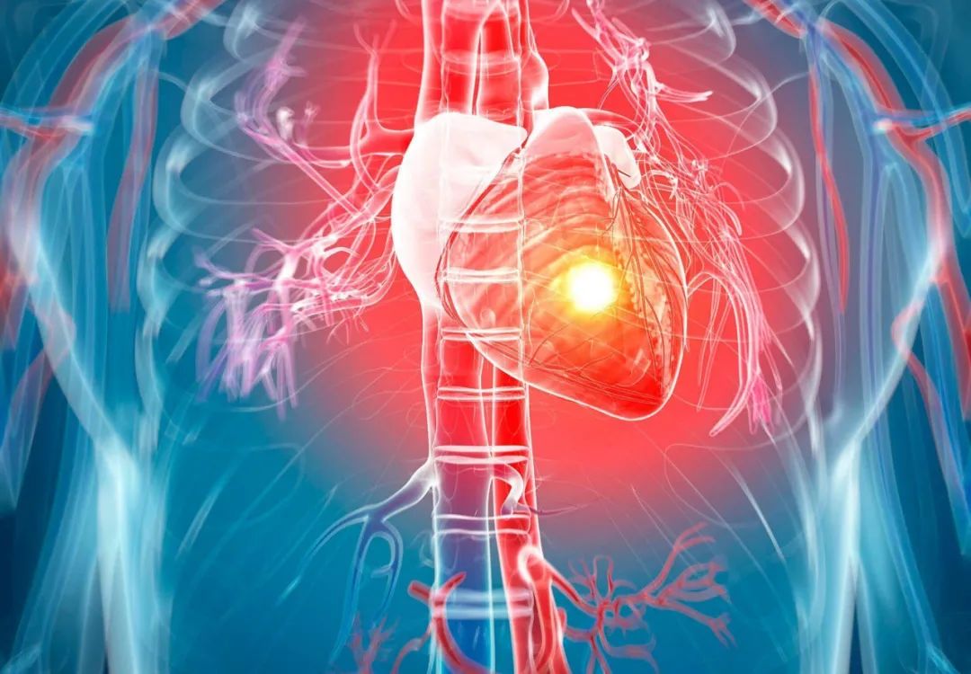 心脑血管疾病是夫妻病?心脑血管疾病出现时,身体会有哪些特征?