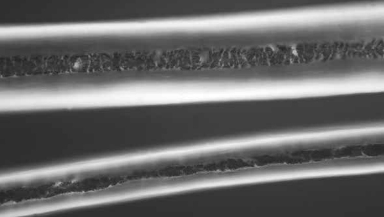 在显微镜下的两根头发