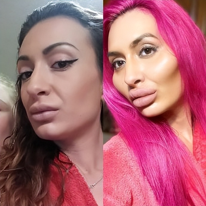 外国女子颧骨高耸大如馒头,自信晒出来感到很美,还想要更大的