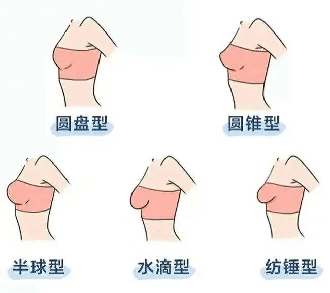 胸部的形状大致有五种,分别为:圆盘型,圆锥型,半球型,水滴型,纺锤型.