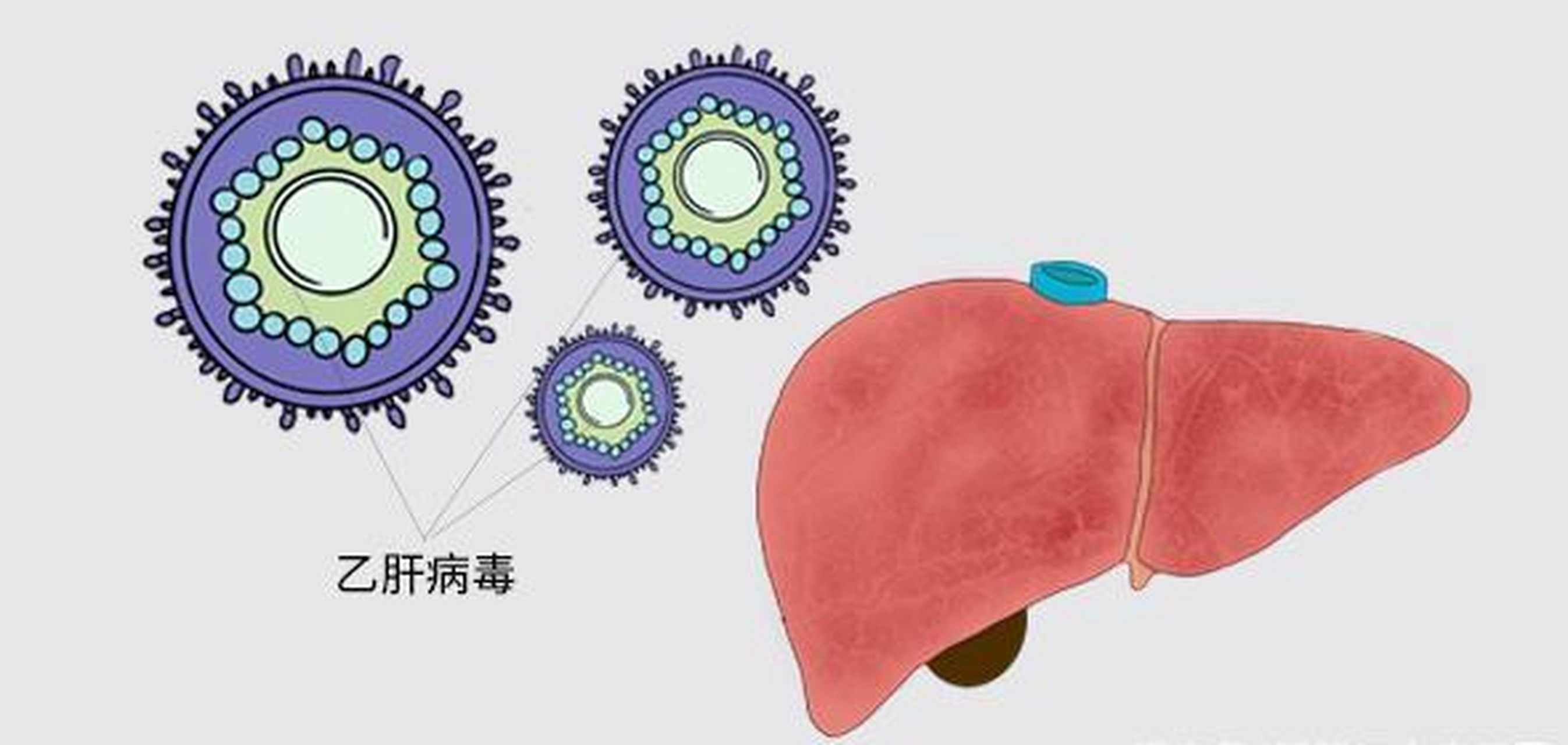 有些乙肝病毒转阴的患者,肝纤维化仍然在进展,这是什么原因?