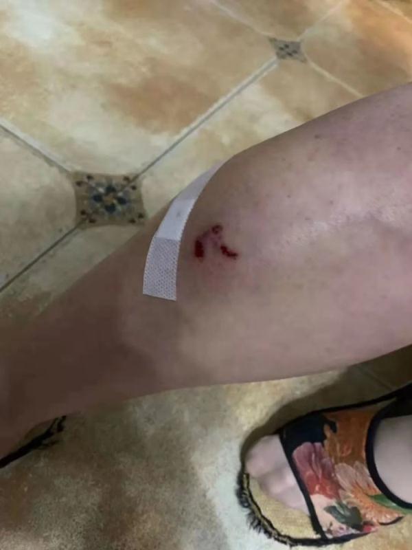 邻居被狗咬伤,男子赔钱后发现不对劲