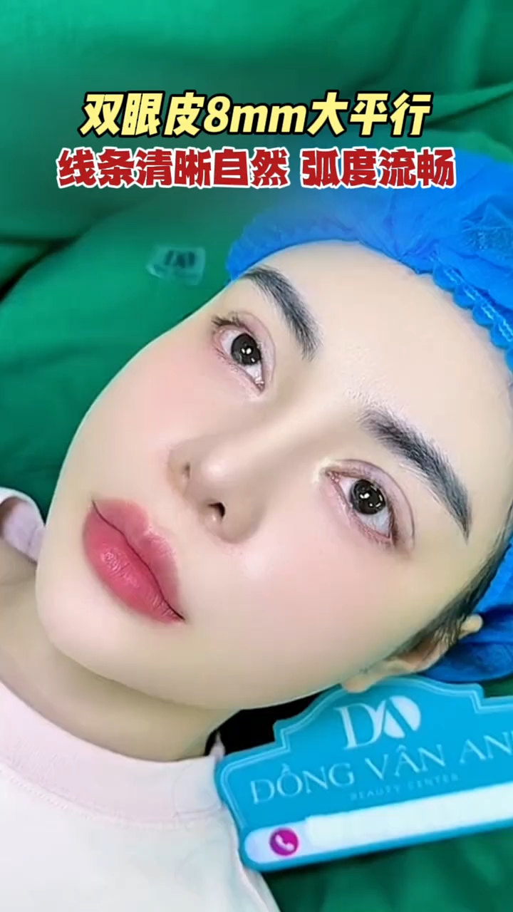 8mm双眼皮平行款