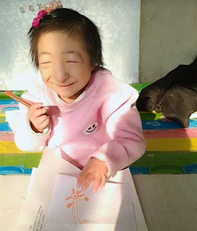 "袖珍女孩"刘爽:19岁身高64厘米,父母因爱坚守从不言弃