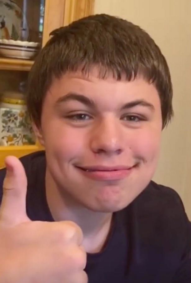 先是他张大嘴巴有人拿卡尺测量宽度,卡尺显示10.88厘米.