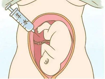 产前诊断,产前筛查,傻傻分不清楚?看这里