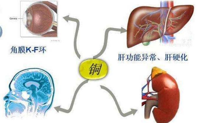 肝窦病图片