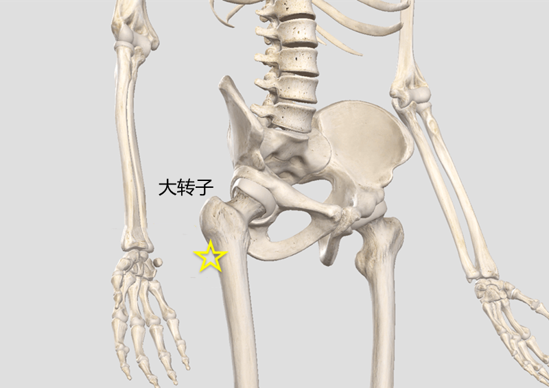 股骨大转子滑囊炎图片