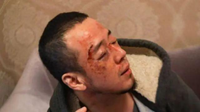 触目惊心知名歌手杨坤被打鼻青眼肿满脸血看完评论我笑了