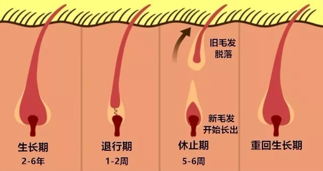 自體毛囊再生種植,你關心的問題都在這裡