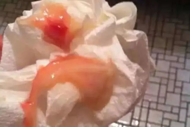 6张鼻涕实图反应孩子健康状况,家长一定要学!