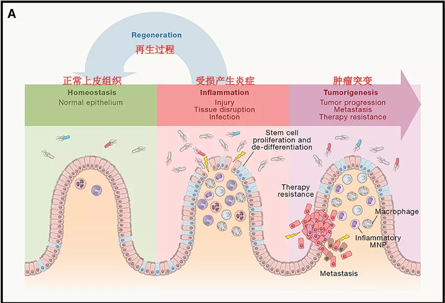 下圖是一個結腸癌的例子,當組織損傷時,會激活炎症反應,然後幹細胞