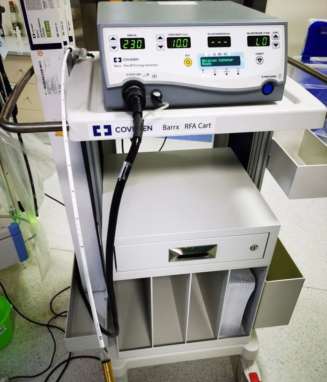 淮安市一院开展首例环周型食管癌前病变射频消融术