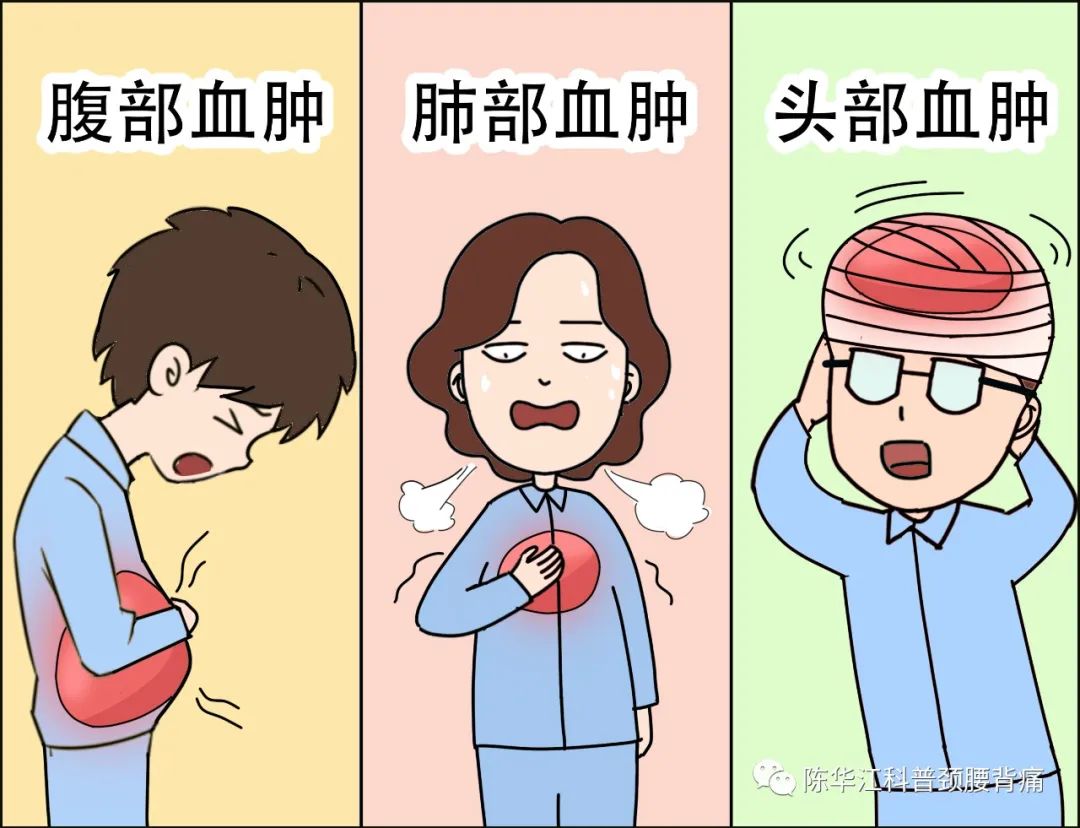 sos!术后血肿(一)